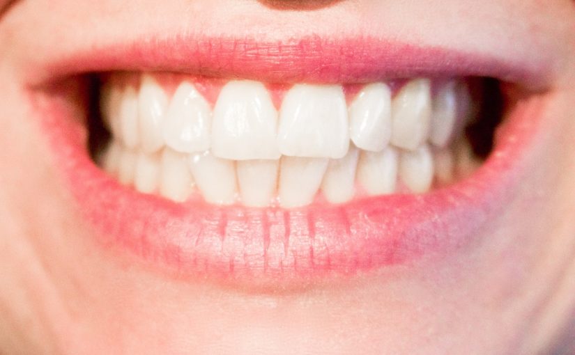 Nowoczesna technologia stosowana w salonach stomatologii estetycznej być może spowodować, że odzyskamy piękny uśmiech.